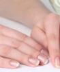 Hangnails on fingers What causes hangnails